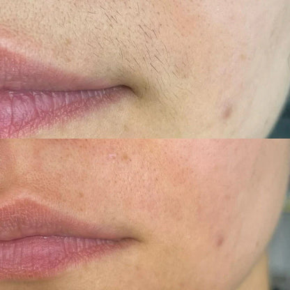 SilkGlide 2-in-1 | Suavidad sin irritación